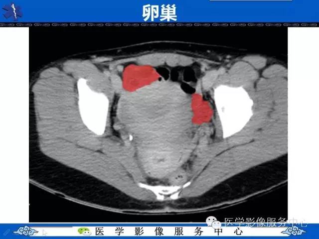 【PPT】盆腔解剖精要