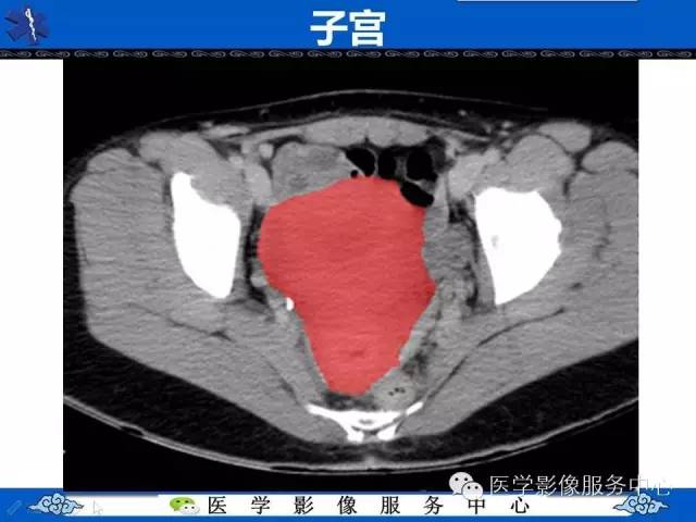 【PPT】盆腔解剖精要