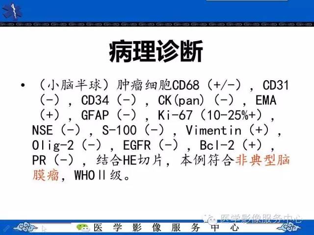 【病例】小脑不典型脑膜瘤1例MR影像表现 【病例】小脑不典型脑膜瘤1例MR影像表现