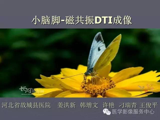【PPT】小脑脚-磁共振DTI成像