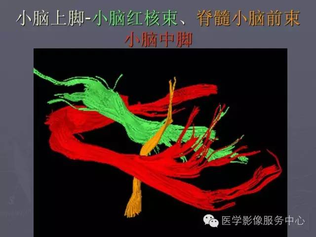 【PPT】小脑脚-磁共振DTI成像