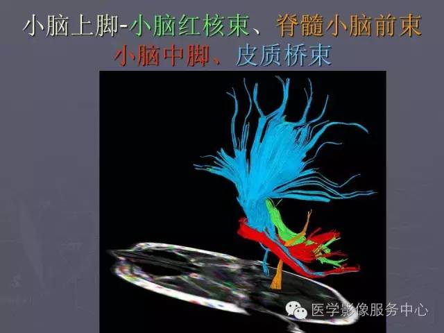 【PPT】小脑脚-磁共振DTI成像