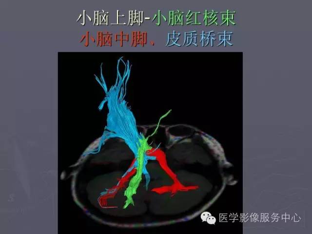 【PPT】小脑脚-磁共振DTI成像