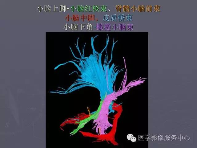 【PPT】小脑脚-磁共振DTI成像