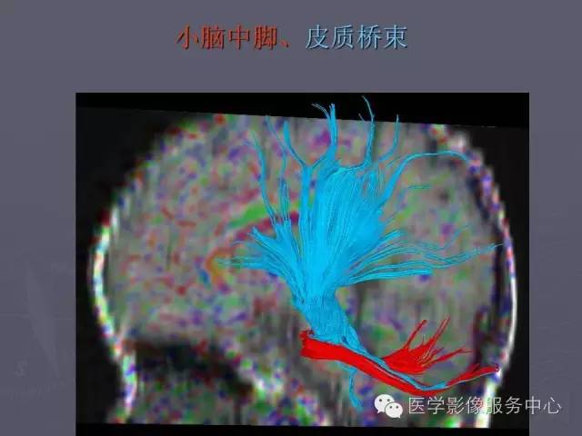 【PPT】小脑脚-磁共振DTI成像