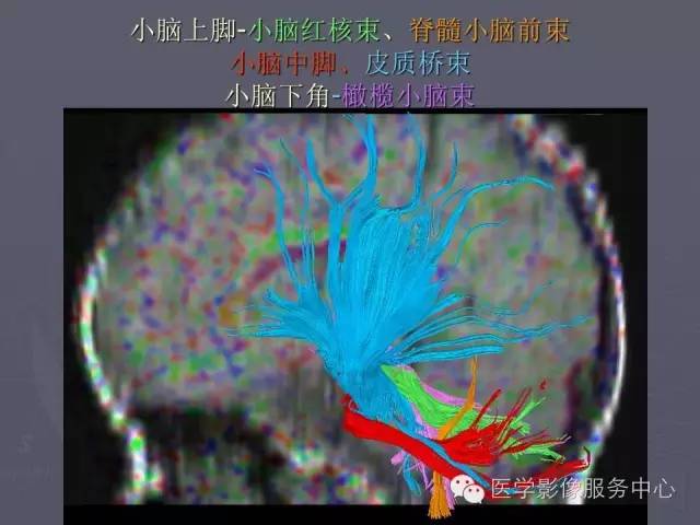 【PPT】小脑脚-磁共振DTI成像
