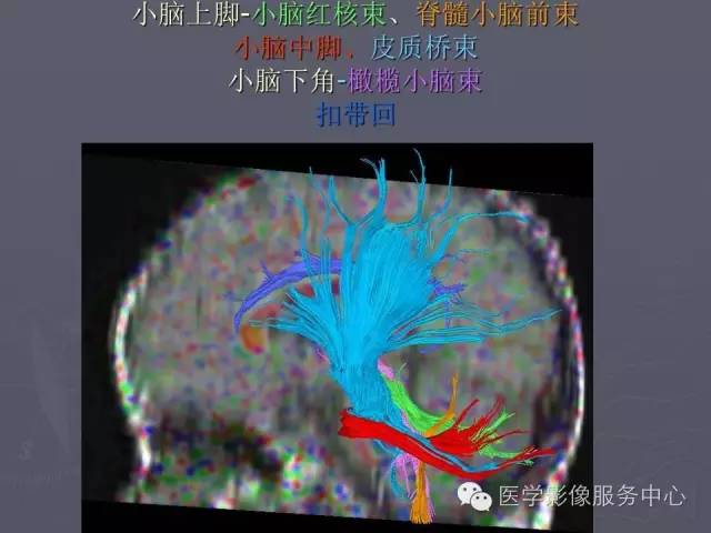 【PPT】小脑脚-磁共振DTI成像