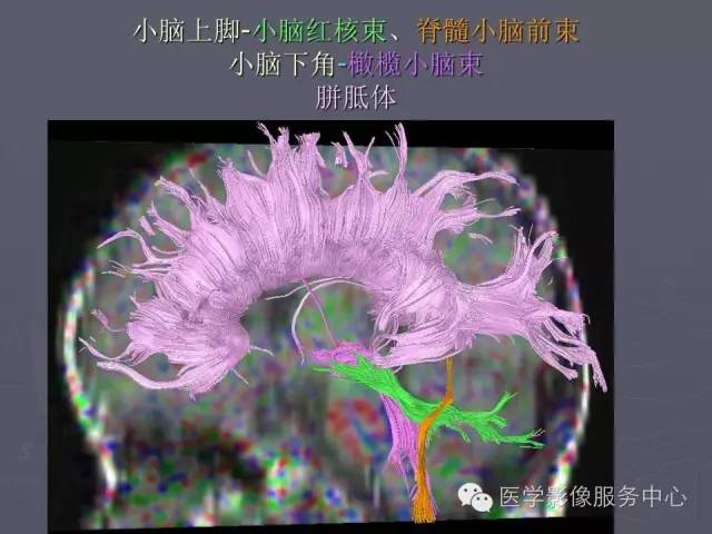 【PPT】小脑脚-磁共振DTI成像