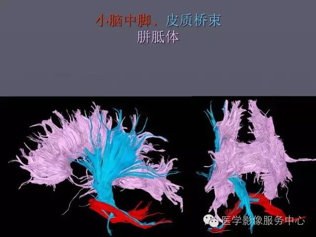 【PPT】小脑脚-磁共振DTI成像