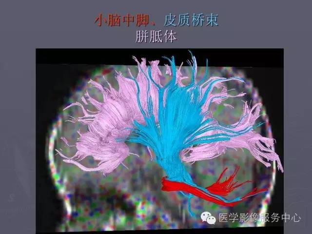 【PPT】小脑脚-磁共振DTI成像
