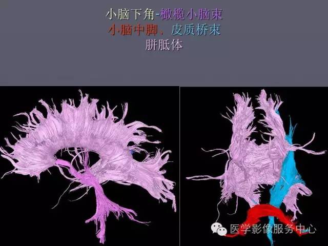【PPT】小脑脚-磁共振DTI成像