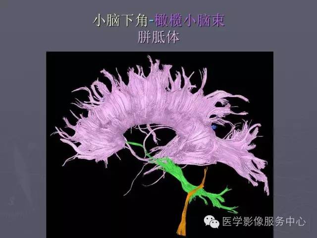 【PPT】小脑脚-磁共振DTI成像