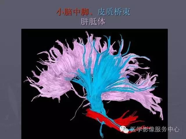 【PPT】小脑脚-磁共振DTI成像