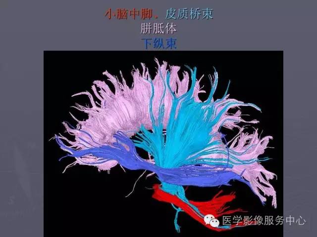 【PPT】小脑脚-磁共振DTI成像