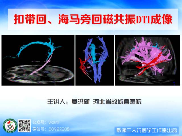 【PPT】扣带回、海马旁回的磁共振DTI成像