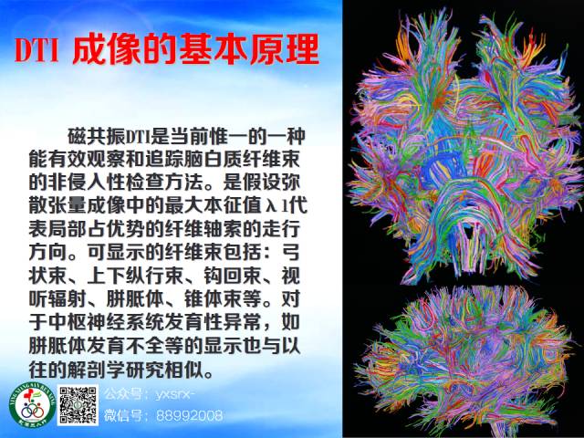 【PPT】扣带回、海马旁回的磁共振DTI成像