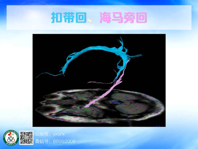 【PPT】扣带回、海马旁回的磁共振DTI成像