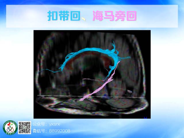 【PPT】扣带回、海马旁回的磁共振DTI成像