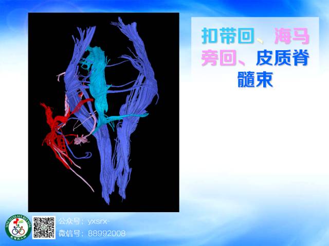 【PPT】扣带回、海马旁回的磁共振DTI成像