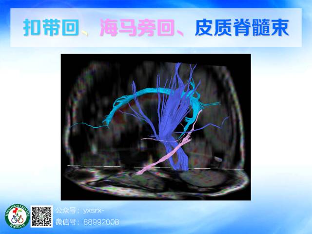【PPT】扣带回、海马旁回的磁共振DTI成像