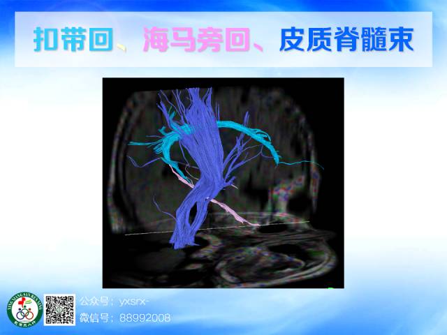 【PPT】扣带回、海马旁回的磁共振DTI成像