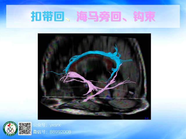 【PPT】扣带回、海马旁回的磁共振DTI成像
