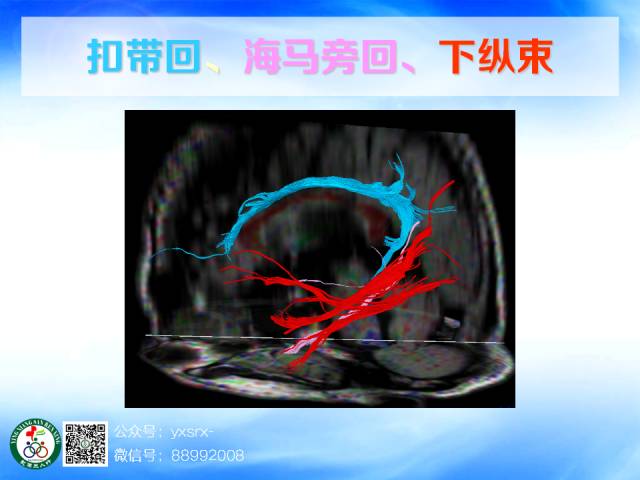 【PPT】扣带回、海马旁回的磁共振DTI成像