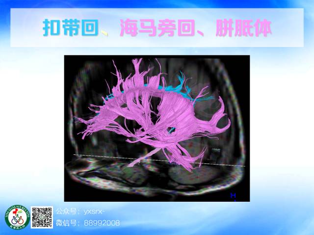 【PPT】扣带回、海马旁回的磁共振DTI成像