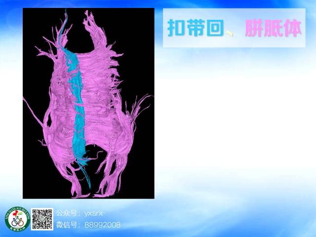 【PPT】扣带回、海马旁回的磁共振DTI成像