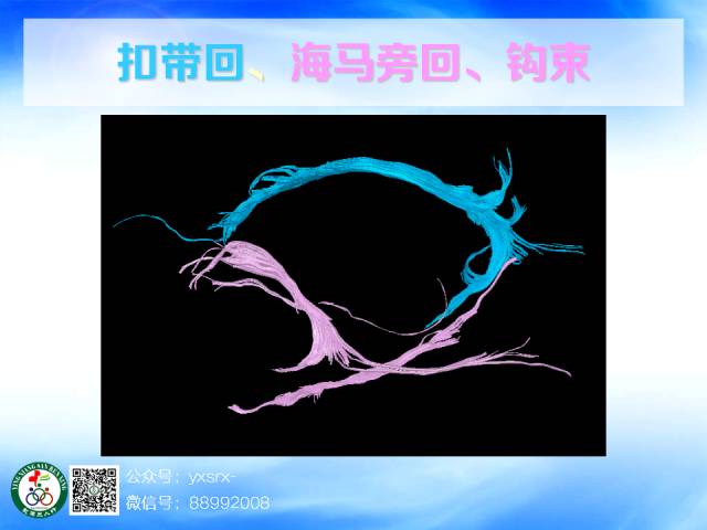 【PPT】扣带回、海马旁回的磁共振DTI成像