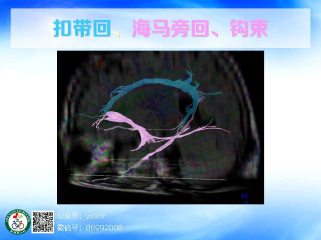 【PPT】扣带回、海马旁回的磁共振DTI成像