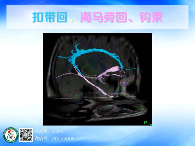 【PPT】扣带回、海马旁回的磁共振DTI成像
