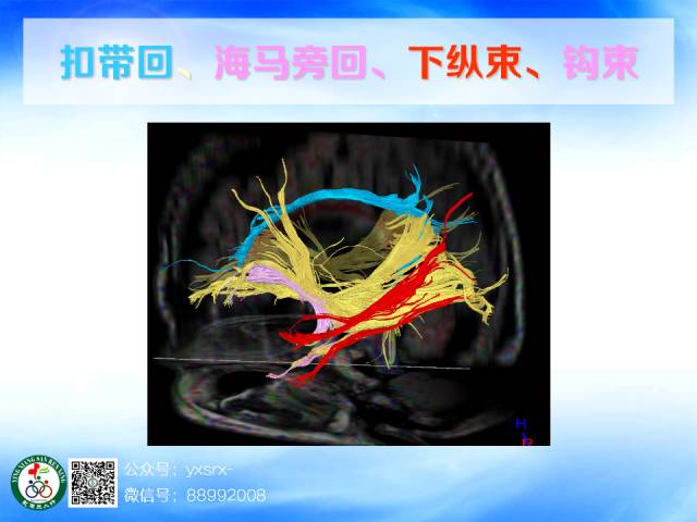 【PPT】扣带回、海马旁回的磁共振DTI成像