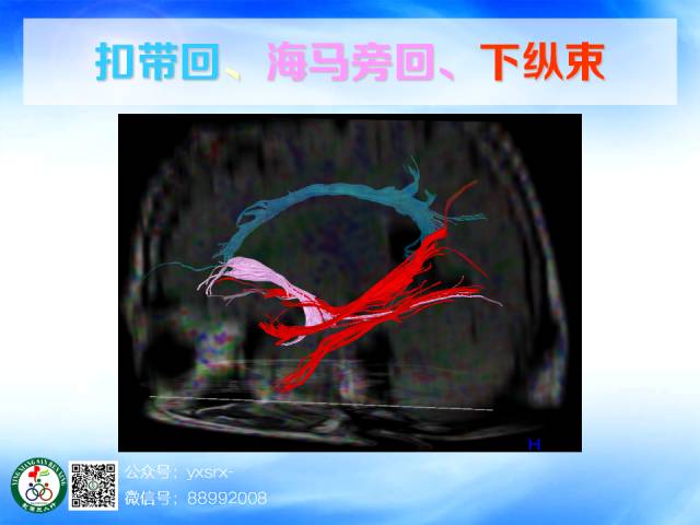 【PPT】扣带回、海马旁回的磁共振DTI成像