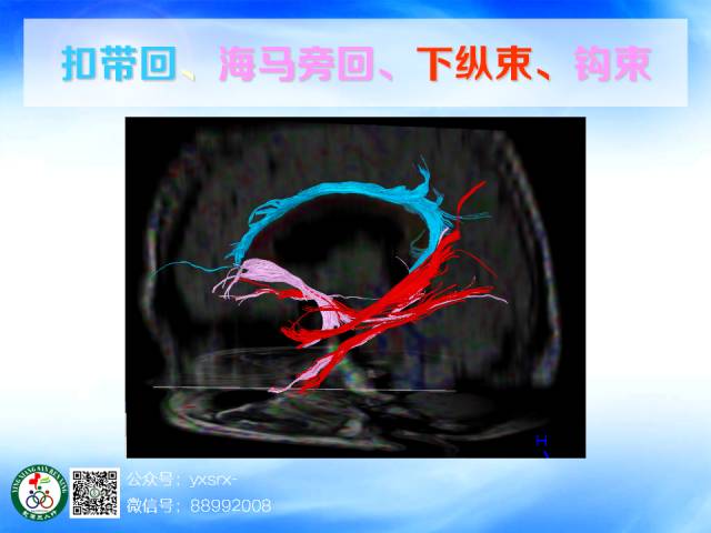 【PPT】扣带回、海马旁回的磁共振DTI成像
