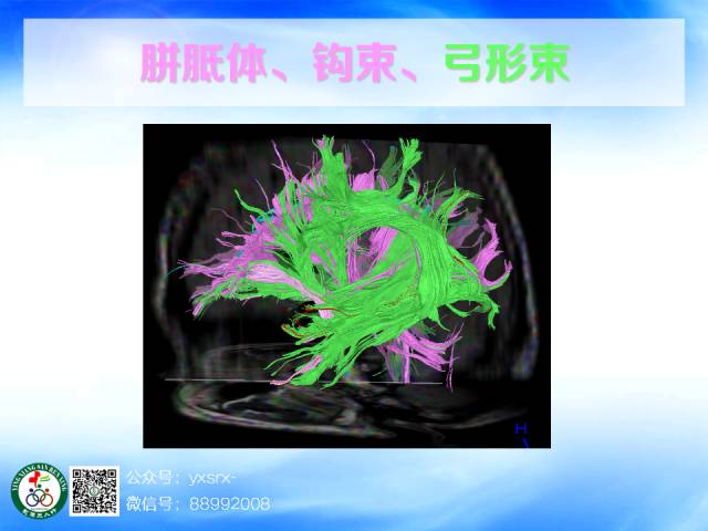 【PPT】扣带回、海马旁回的磁共振DTI成像