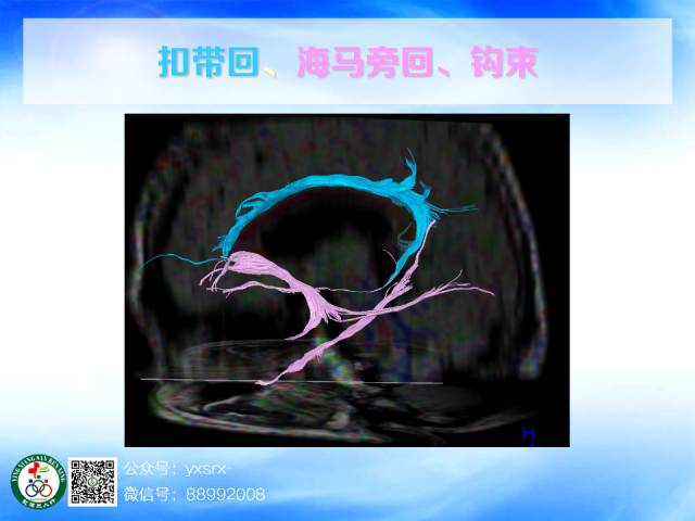 【PPT】扣带回、海马旁回的磁共振DTI成像