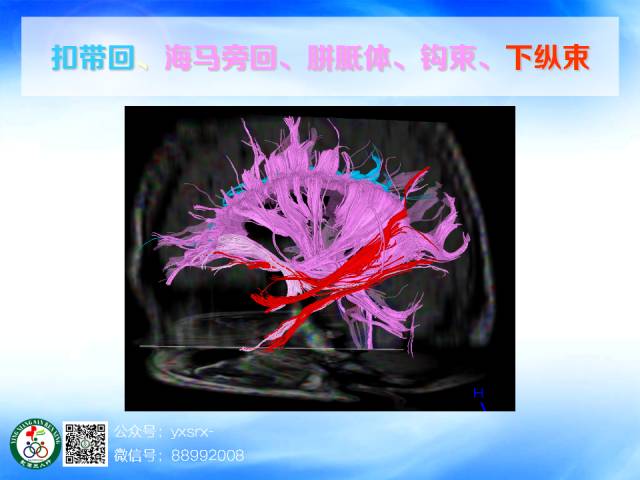 【PPT】扣带回、海马旁回的磁共振DTI成像