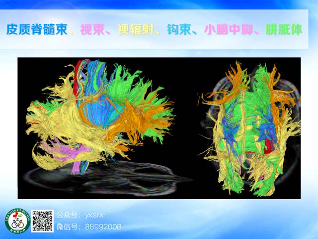【PPT】扣带回、海马旁回的磁共振DTI成像
