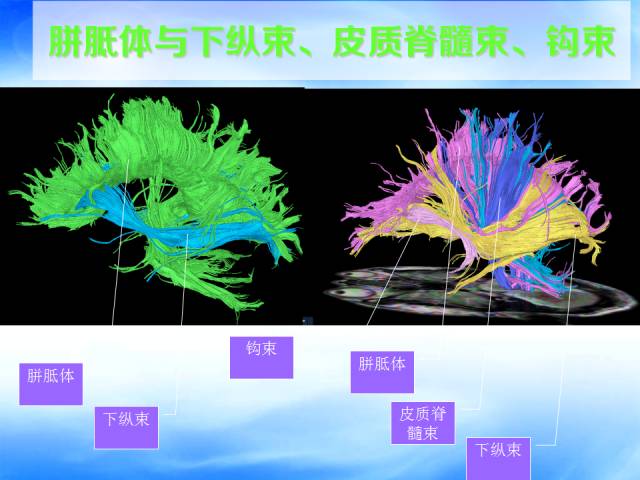 【PPT】扣带回、海马旁回的磁共振DTI成像