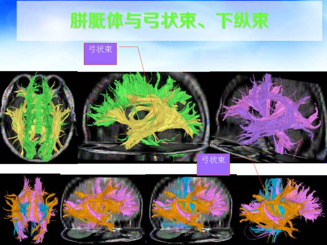 【PPT】扣带回、海马旁回的磁共振DTI成像