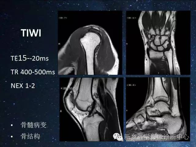 【PPT】骨关节MR扫描及注意事项