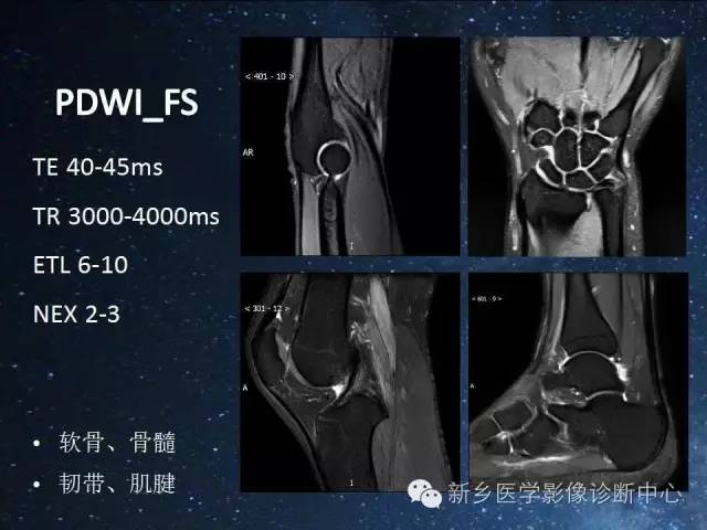 【PPT】骨关节MR扫描及注意事项