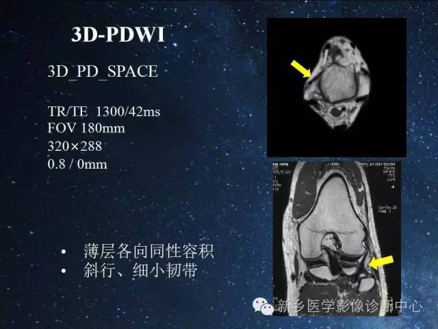 【PPT】骨关节MR扫描及注意事项