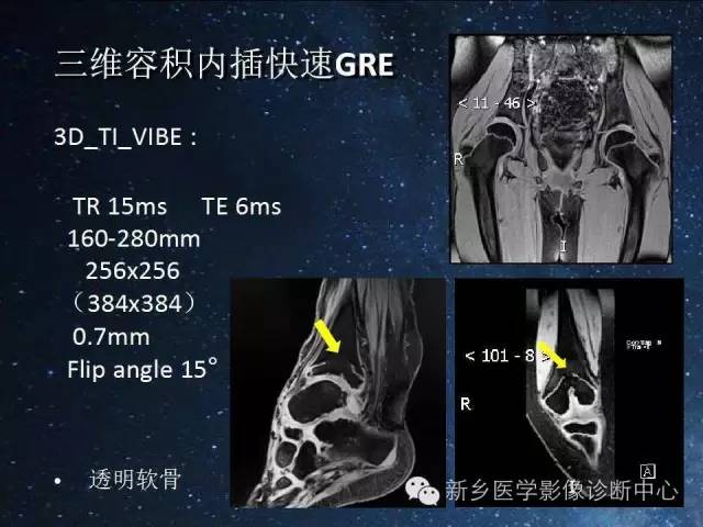 【PPT】骨关节MR扫描及注意事项
