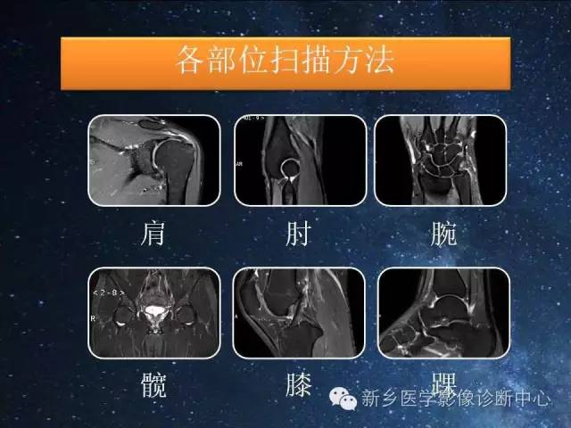 【PPT】骨关节MR扫描及注意事项