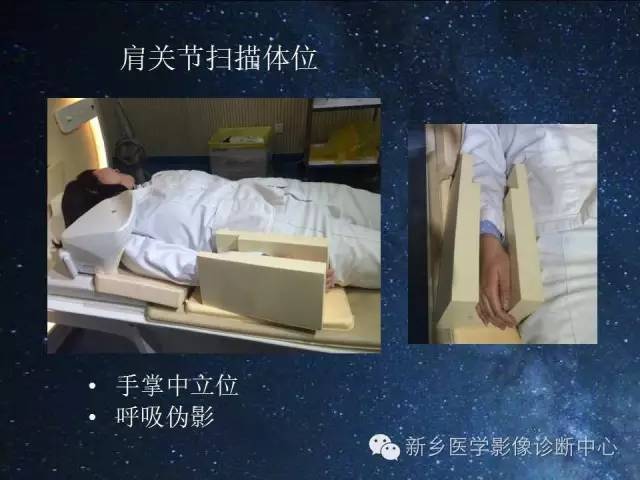 【PPT】骨关节MR扫描及注意事项