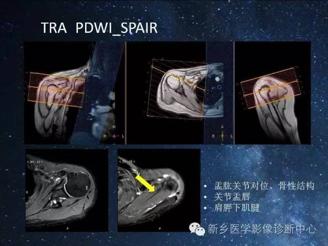 【PPT】骨关节MR扫描及注意事项