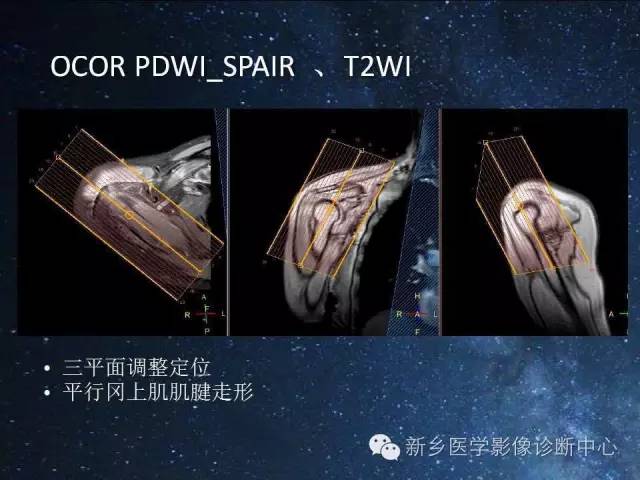 【PPT】骨关节MR扫描及注意事项