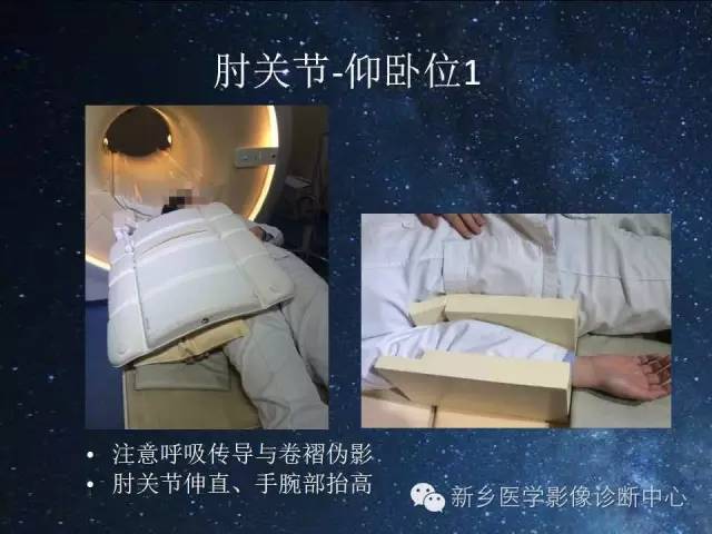 【PPT】骨关节MR扫描及注意事项
